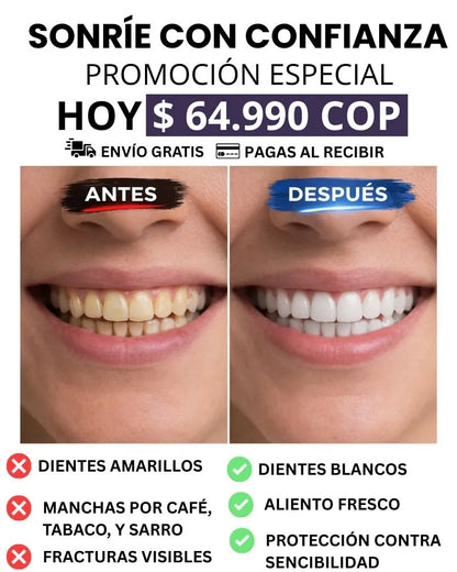 BLANQUEADOR DENTAL GRANDE TIENDA OFICIAL PROMO ESPECIAL