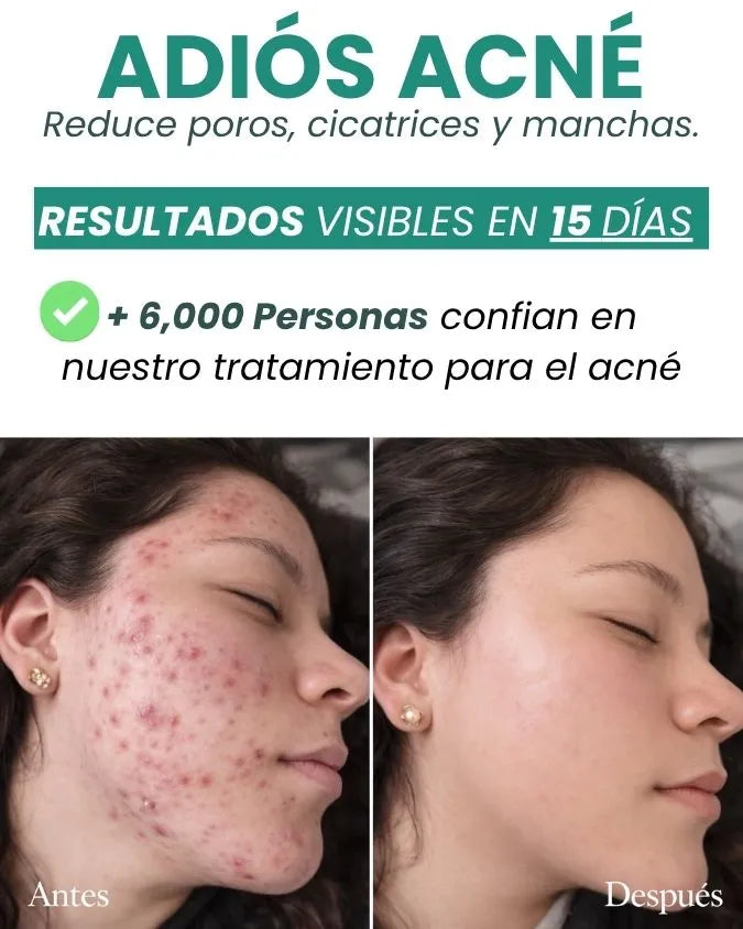 DUO RECUPERA TU PIEL + OBSEQUIO