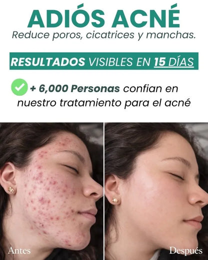 DUO RECUPERA TU PIEL + OBSEQUIO