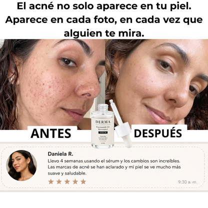 SERUM Niacinamida10+ y Resveratrol