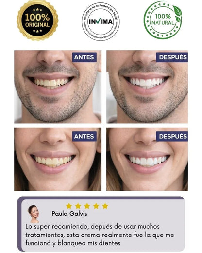 BLANQUEADOR DENTAL GRANDE TIENDA OFICIAL PROMO ESPECIAL