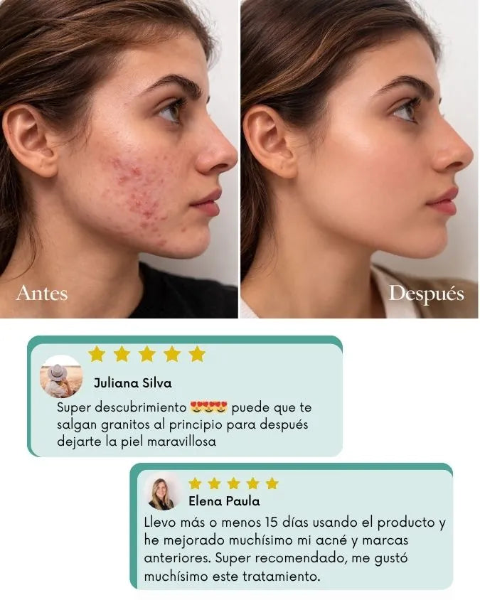 DUO RECUPERA TU PIEL + OBSEQUIO