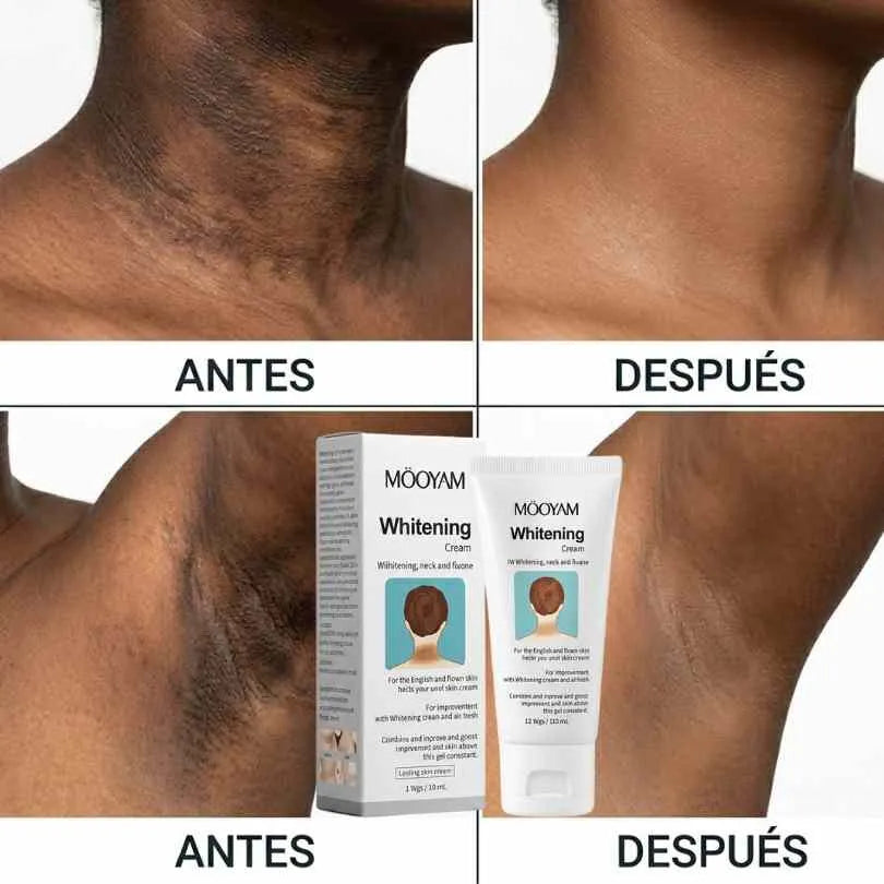 Mooyam Crema aclarante   - Esas axilas y entrepierna que se ven negras se aclaran en 30 días