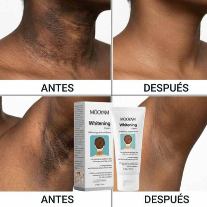 Mooyam Crema aclarante   - Esas axilas y entrepierna que se ven negras se aclaran en 30 días